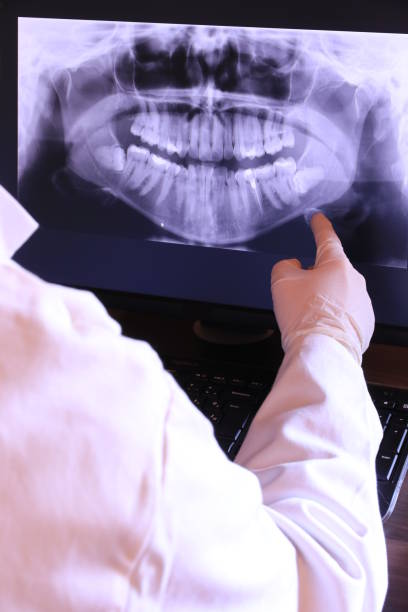 Best Emergency Denture Repair in Milford, OH