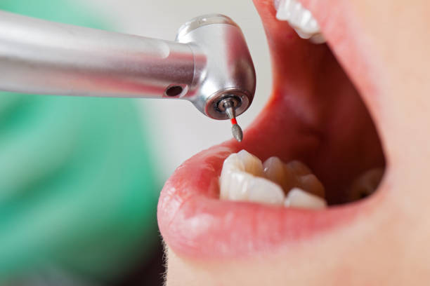Best Emergency Gum Treatment in Milford, OH